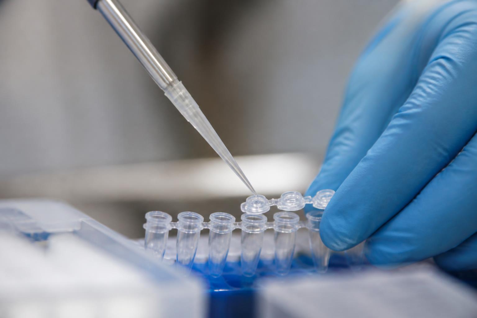 Scientist pipetting reagents into PCR tubes